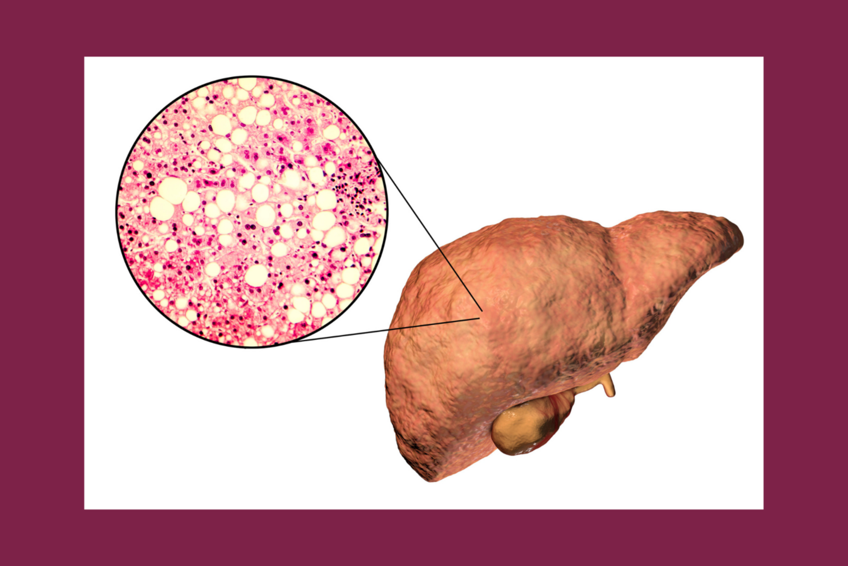 Liver Diseases N Lorem liver-diseases-n-lorem